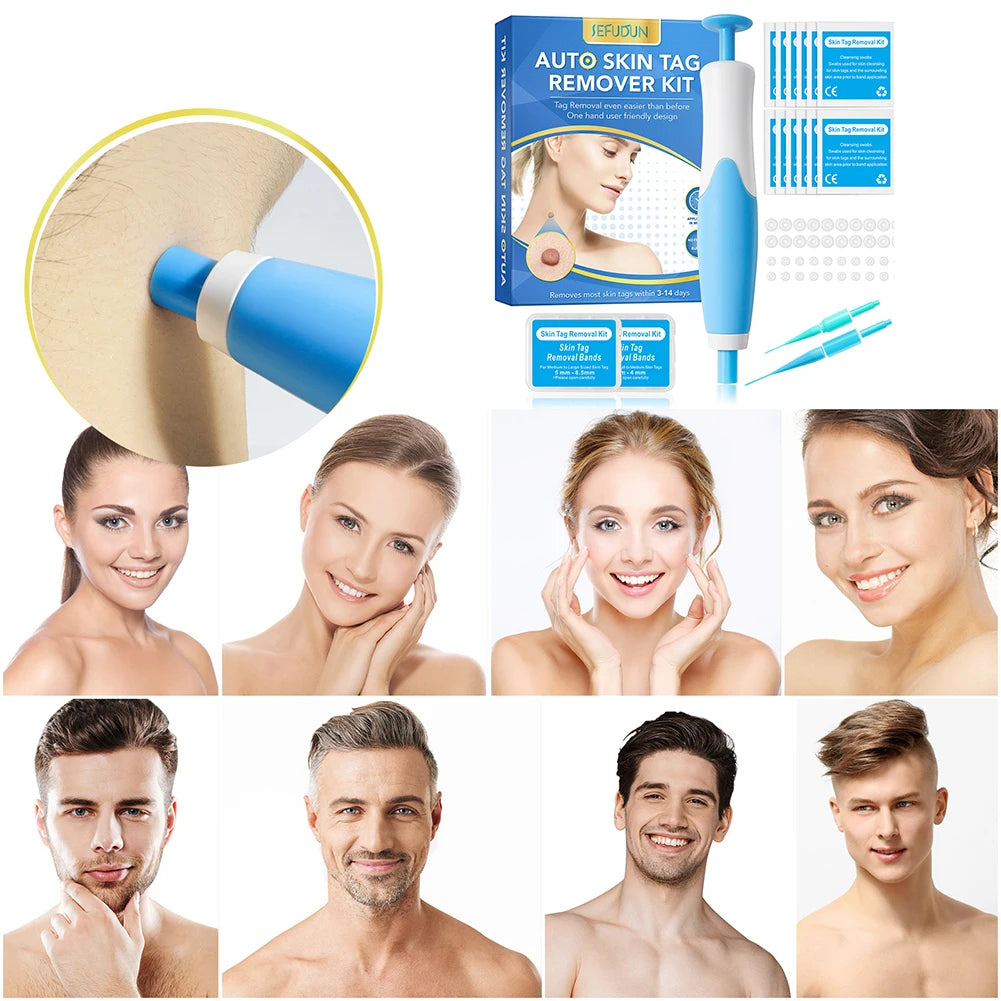 2 IN 1 Auto Micro Skin Tag Remover, micro & regular Skin Tag Removal Kit, Adult Mole Wart Remover, Face Care Beauty Tools